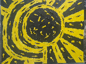 " VERTIGO-DIZZINESS"
